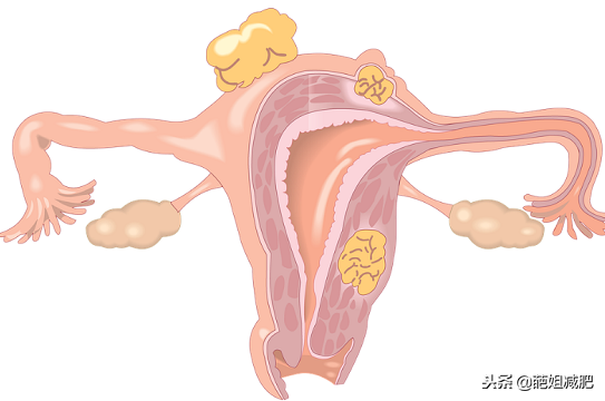 妇科医生：不良的习惯会诱发“卵巢早衰”牢记这6点可保养卵巢