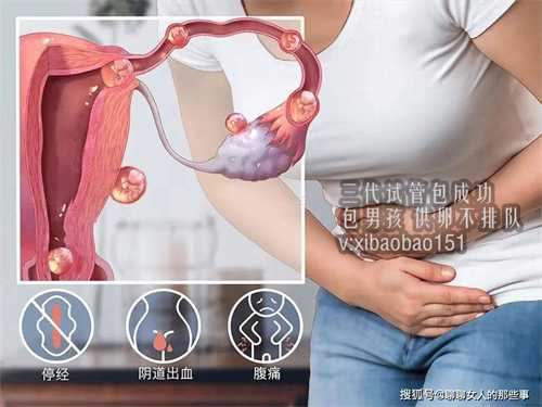 广州代生中介信息,子宫内膜异位症是怎么回事